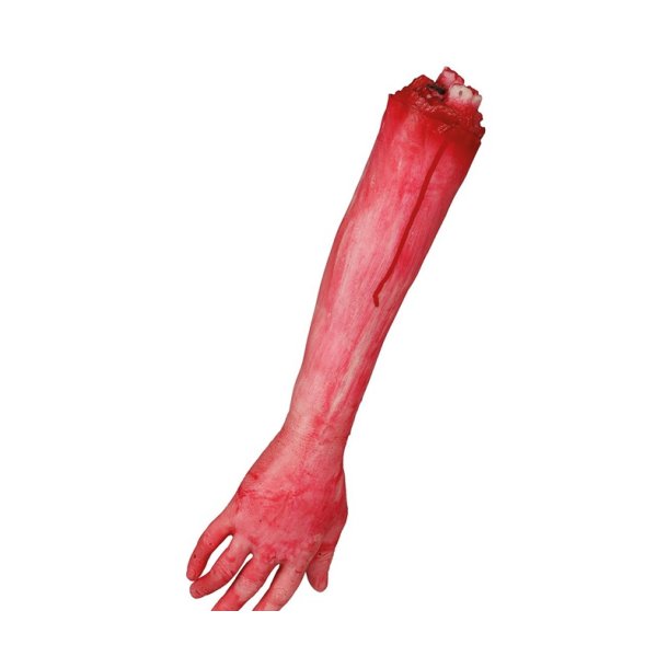 Afskret arm
